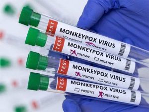 monkeypox samples