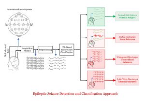 Approach to detect and classify epileptic seizures 